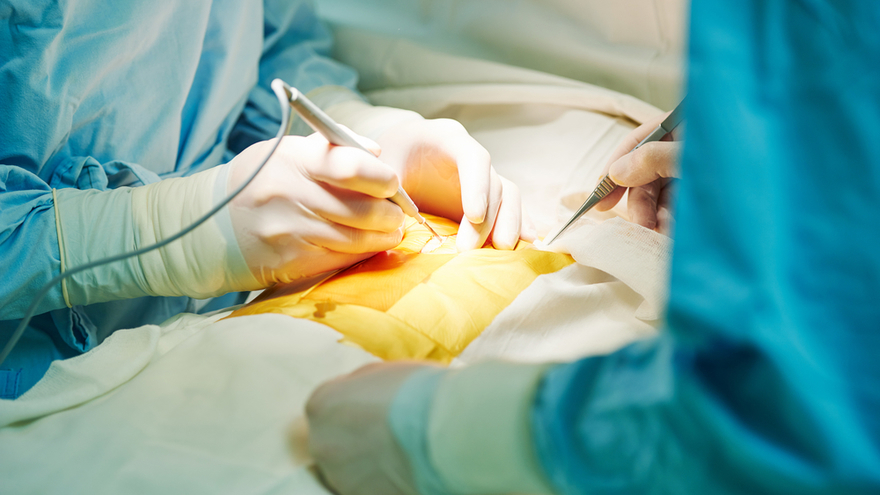 Chirurgie de la scoliose