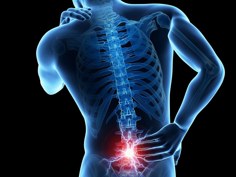 Back Pain Problems