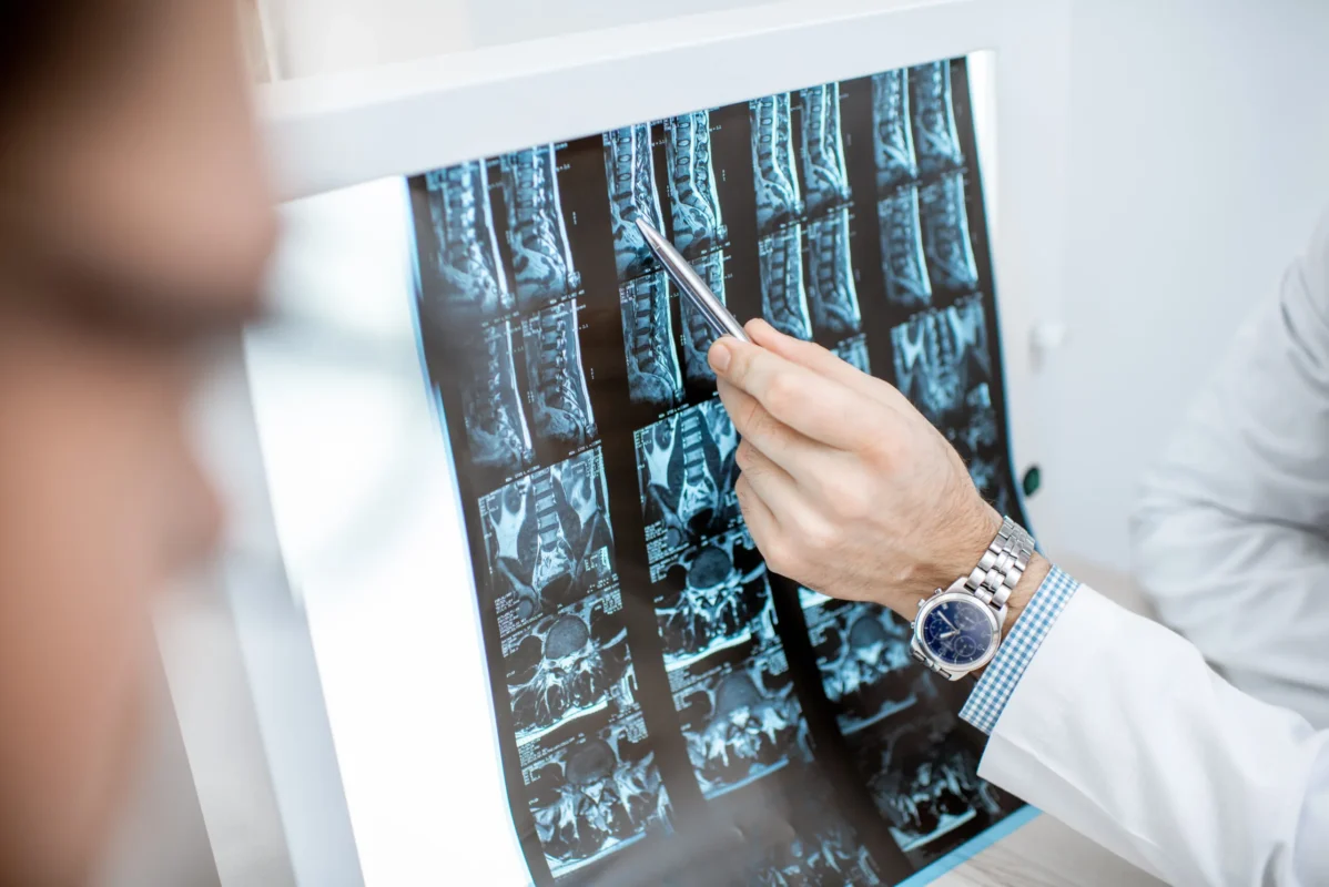 Scoliosis Surgery