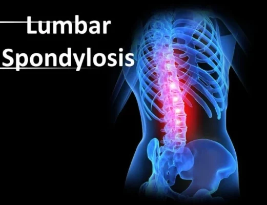 How Scoliosis Impacts Chest Structure and Function: Key Issues and Treatment Options Explained