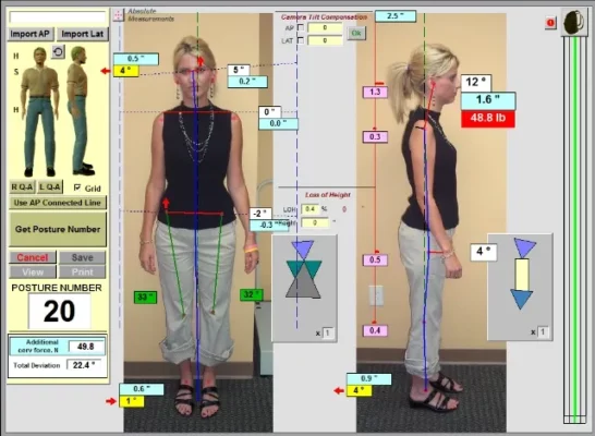 Digital Posture Analysis Technology for Chiropractors