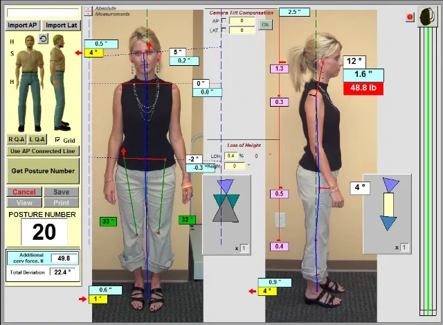 Digital Posture Analysis Technology for Chiropractors