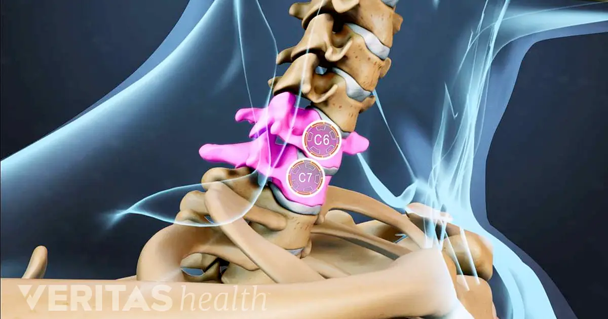Vértebras cervicales C7