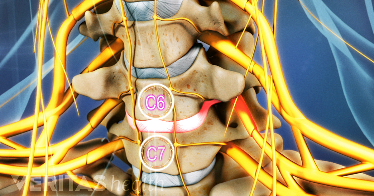 Vértebras cervicales C7