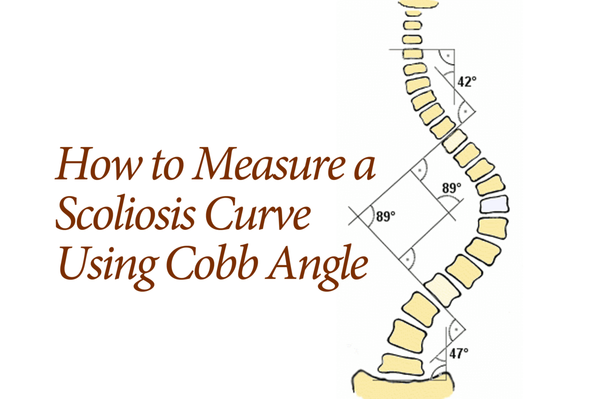 How To Measure Spine Curvature?