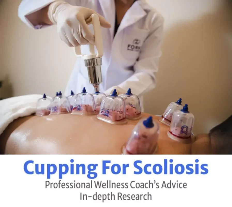 Cupping Therapy as a Treatment for Scoliosis