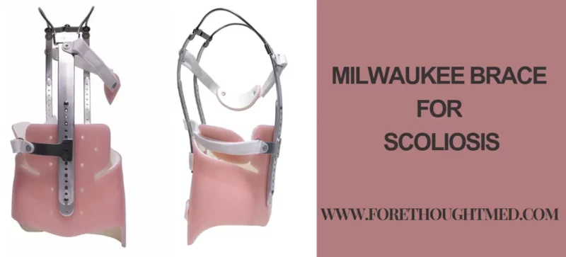 Cinta de Milwaukee para escoliose: Compreender o seu papel no apoio e correção da coluna vertebral