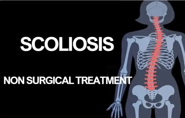 Scoliosis Non Surgical Treatment