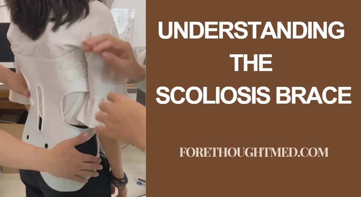 Die Skoliose-Klammer verstehen: Ein umfassender Leitfaden für Erwachsene Skoliose-Korsett für Erwachsene