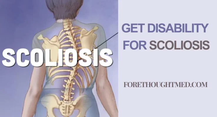 Assoziiert mit dem Erhalt einer Invalidität wegen Skoliose