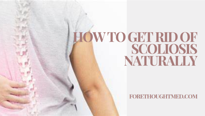 Exploración de tratamientos alternativos y enfoques naturales para tratar la escoliosis sin intervención quirúrgica