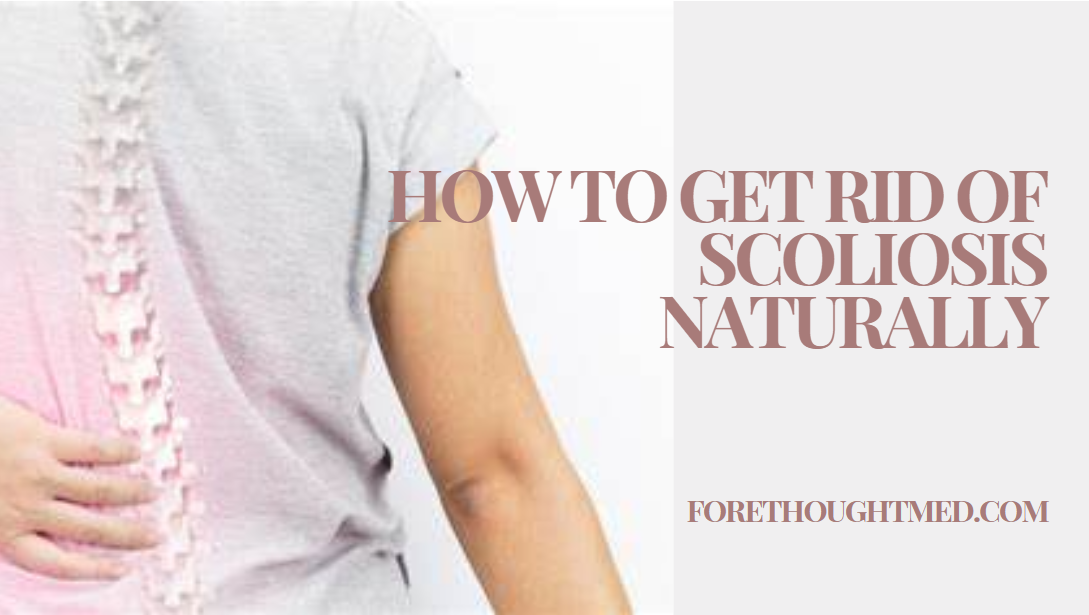 Exploring Alternative Treatments and Natural Approaches for Managing Scoliosis Without Surgical Intervention