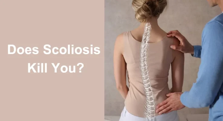 Does Scoliosis Kill You: Evaluating the Life-Threatening Aspects of Scoliosis and What You Need to Know