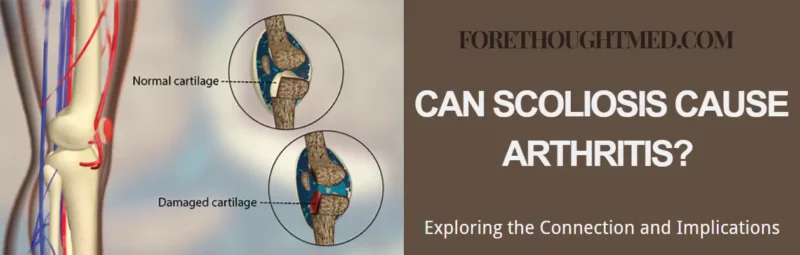 A escoliose pode causar artrite? Explorando a conexão e as implicações