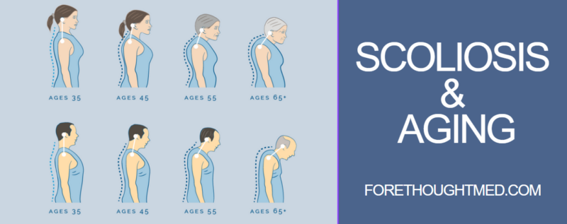 ¿Puede ayudar la fisioterapia a la escoliosis? Evaluación de los beneficios y la eficacia de la fisioterapia para tratar la escoliosis