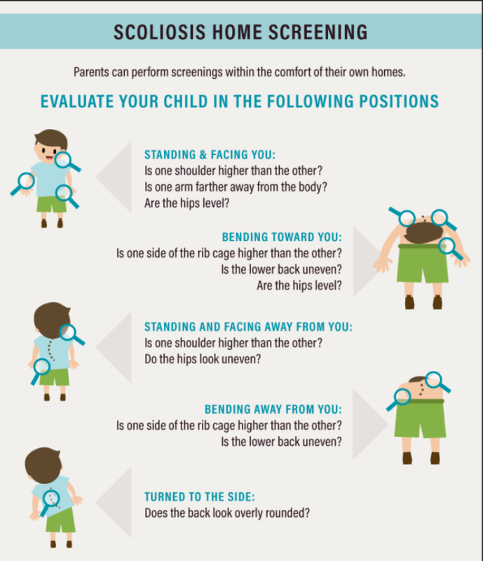 脊柱側湾症検診ガイドライン