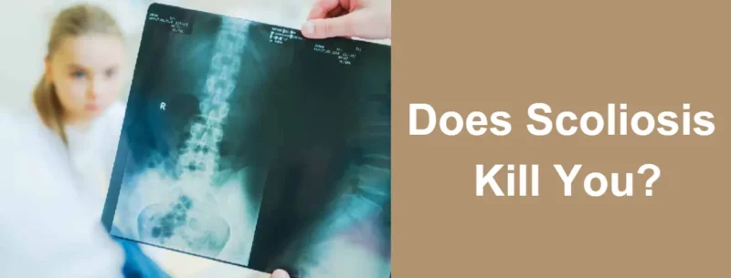 脊柱側湾症はあなたを殺せるか？進行した脊柱側弯症が致命的な結果をもたらす可能性についての懸念に取り組む