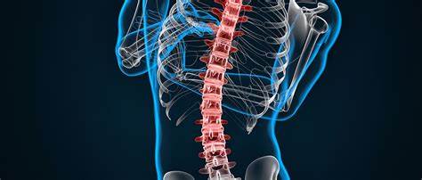 Dextroconvex Scoliosis of the Thoracic Spine: A Comprehensive Guide to Treating and Managing Dextroconvex Scoliosis in the Thoracic Region