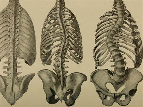 Compreender a anatomia da escoliose: principais alterações estruturais e suas implicações