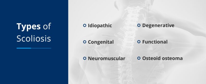 Classification of Scoliosis: A Comprehensive Guide to Types and Severity Levels