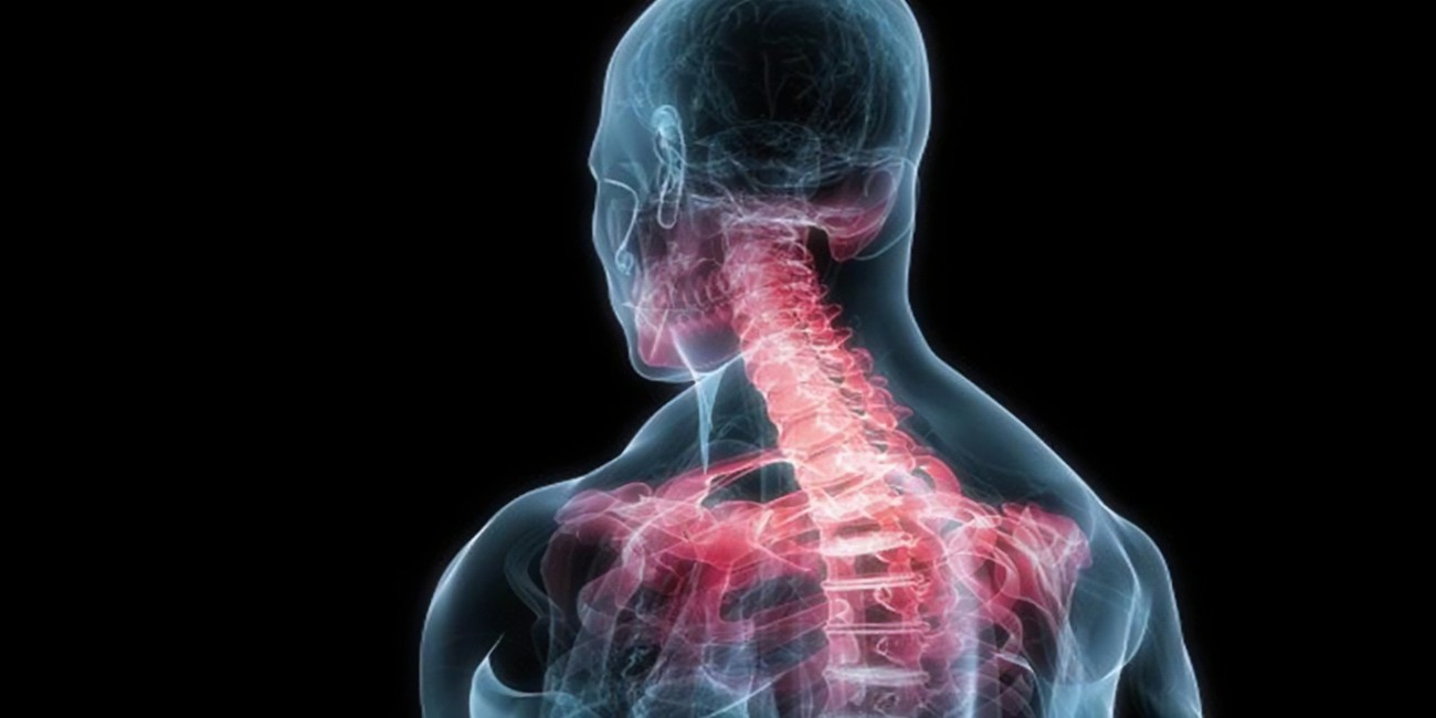Escoliose Coluna cervical