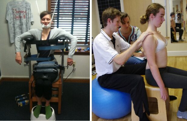 Traitement clair de la scoliose : Approches globales pour obtenir des résultats clairs et positifs dans le traitement de la scoliose