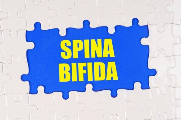 Spina Bifida Scoliosis
