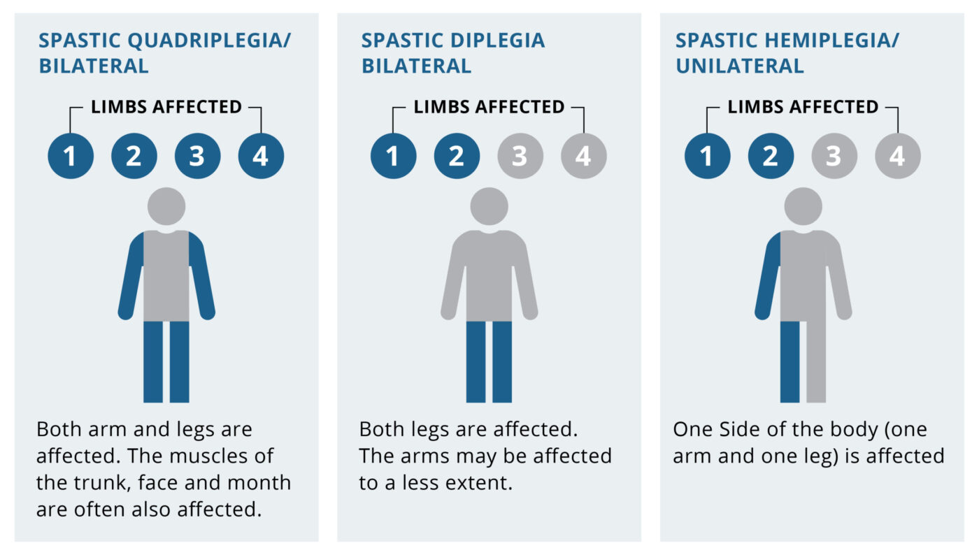 Cerebral Palsy and Scoliosis