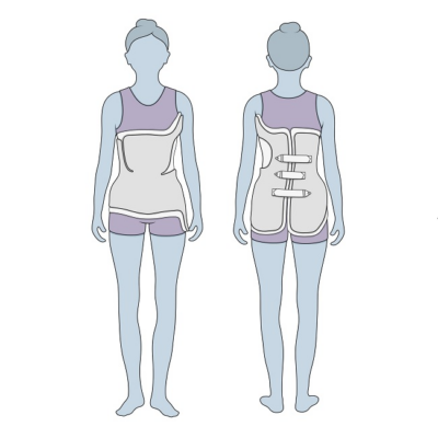 Top Back Braces for Scoliosis: Comprehensive Guide & Selection Tips