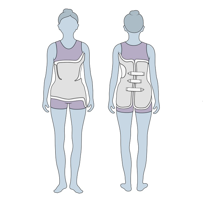 Top Back Braces for Scoliosis: Comprehensive Guide & Selection Tips