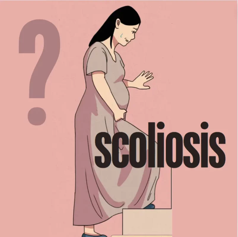 Can Pregnancy Cause Scoliosis? Exploring Risk Factors and Preventative Measures for Healthcare Providers