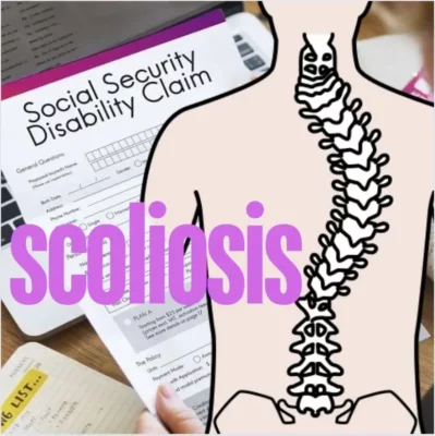 Infographic on scoliosis and Disability Living Allowance (DLA): eligibility criteria, benefits, and support available for scoliosis patients.