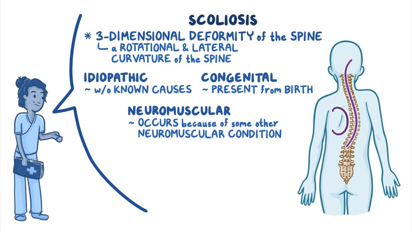 patient education for scoliosis