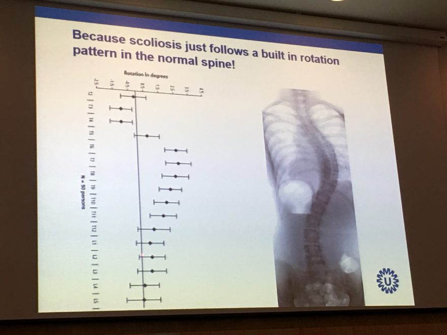 Which of the Following Describes Structural Scoliosis