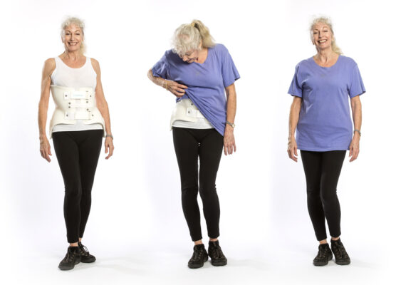 Scoliosis in Elderly Woman