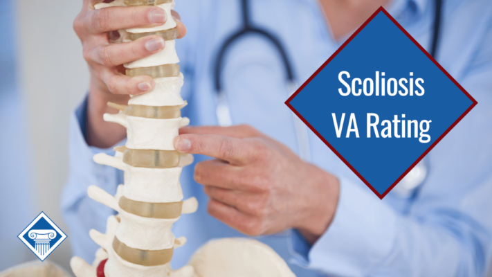Scoliosis VA Rating Reddit