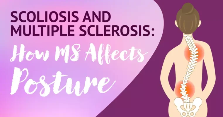 Hypermobility Scoliosis