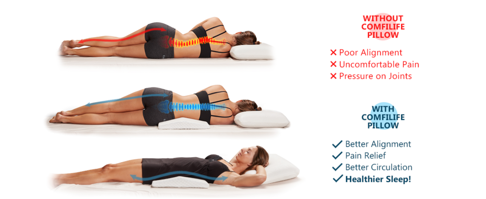 Scoliosis Pillow Amazon Finding The Ideal Pillow For Scoliosis Relief scoliosis-pillow-amazon-finding-the-ideal-pillow-for-scoliosis-relief