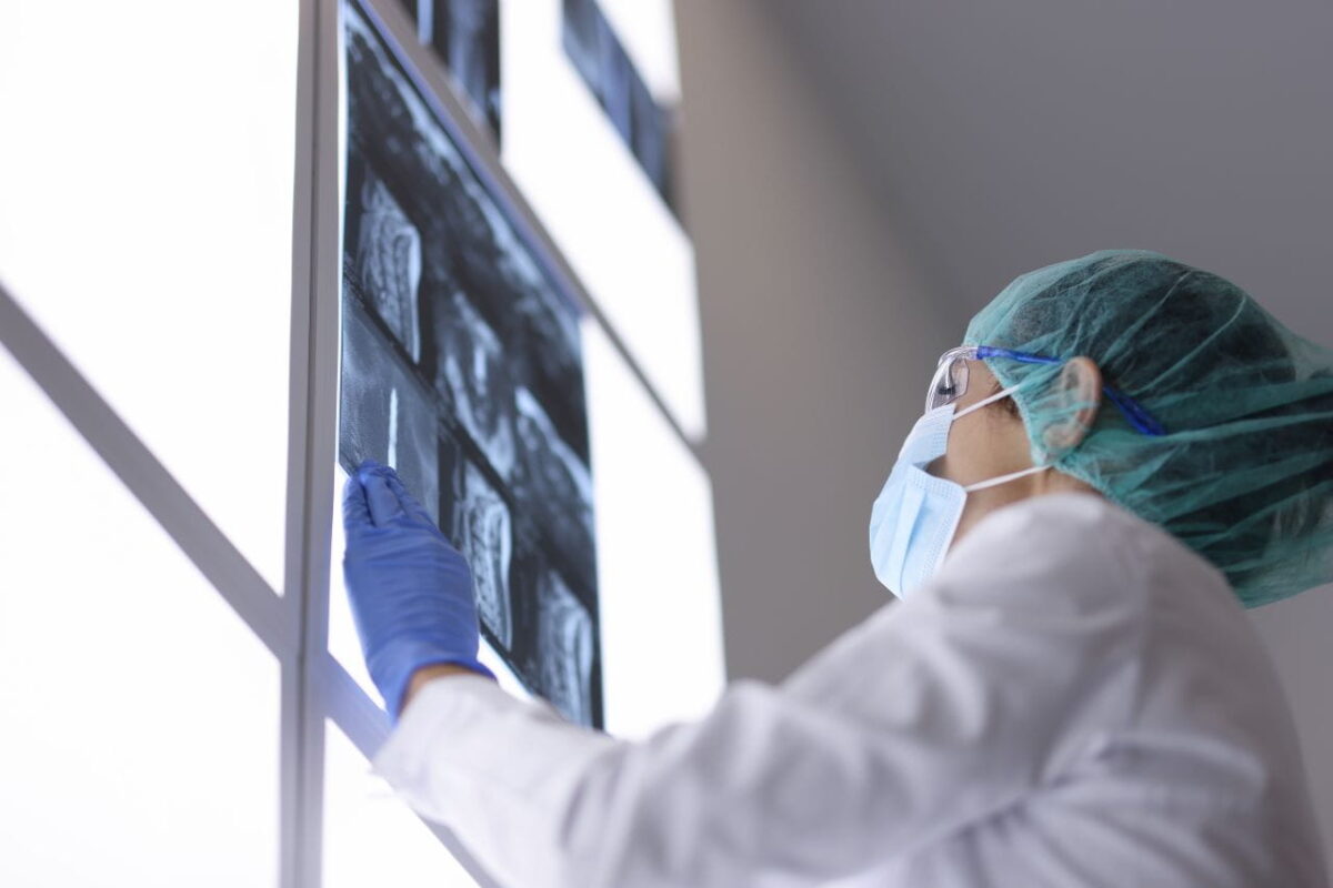 Scoliosis Operation Recovery Time